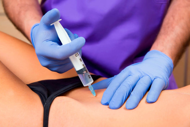 Intradermoterapia
É uma técnica minimamente invasiva que envolve uma série de injeções de substâncias para diferentes disfunções estéticas, como: celulite, gordura localizada e alta performance, alopecia, estria, flacidez, manchas, emagrecimento, ganho de massa e rejuvenescimento.