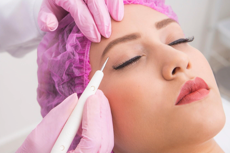 Jato de plasma Procedimento utilizado para tratar rugas, linhas finas, manchas escuras na pele, estrias e remoção de algumas verrugas, aumenta a produção de colágeno e elas tina, melhora consideravelmente o tonus da pele porque facilita a entrada de ativos na pele.