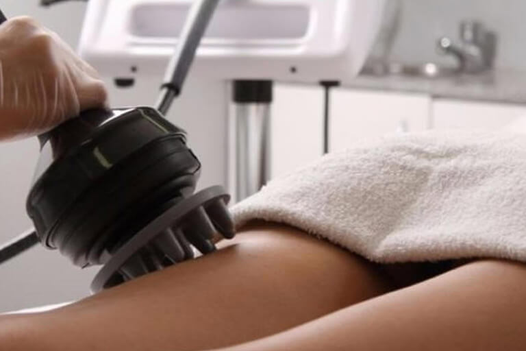 Endermologia Vibratória É uma excelente opção para o tratamento de celulite e gordura localizada sem utilização de agulhas. A endermologia vibratória consiste em uma massagem realizada com um aparelho que se chama Modellata, onde, ao ser realizado, ocorre ativação sanguínea no local, promovendo melhor oxigenação da pele, melhorando a celulite e, também a remodelação corporal.